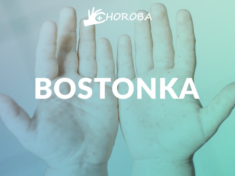 Więcej o: Bostonka Więcej o: Bostonka